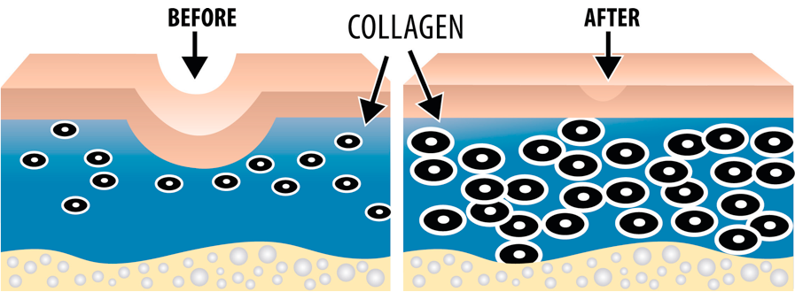 viên uống collagen, collagen+c, collagen của mỹ, viên uống đẹp da, viên uống đẹp da collagen c, 350viên uống collagen